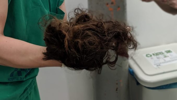 Jovem tem couro cabeludo arrancado durante corrida de kart no Recife